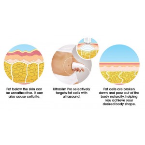 Ultradźwiękowy masażer Homedics Ultraslim PRO 